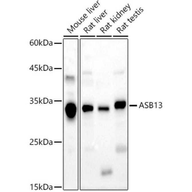 ASB13 Rabbit Polyclonal Antibody