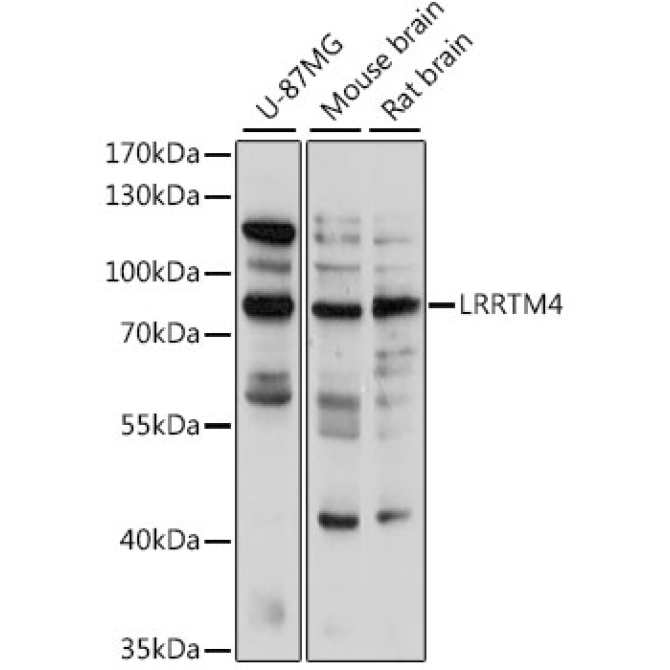 LRRTM4 Rabbit Polyclonal Antibody