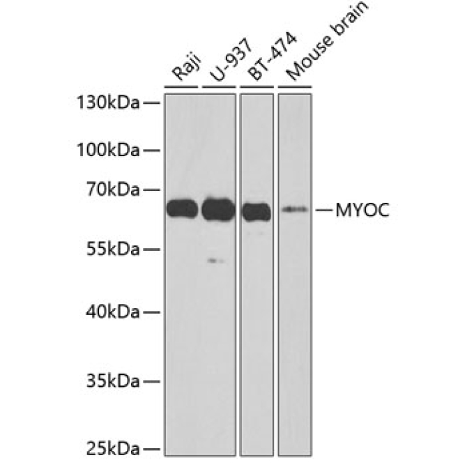 MYOC Rabbit Polyclonal Antibody