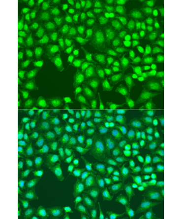 Defb26 Rabbit Polyclonal Antibody