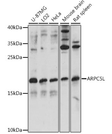 ARPC5L Rabbit Polyclonal Antibody