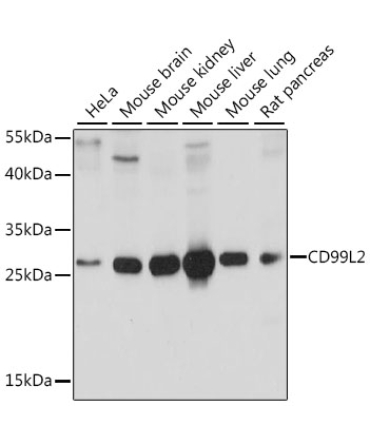 CD99L2 Rabbit Polyclonal Antibody