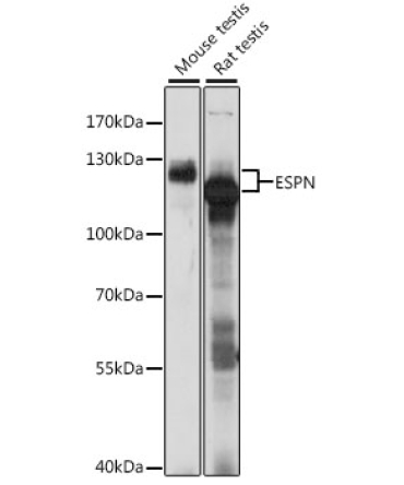 ESPN Rabbit Polyclonal Antibody