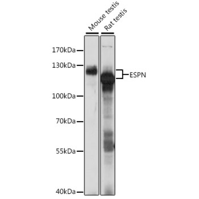 ESPN Rabbit Polyclonal Antibody