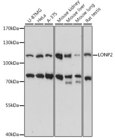 LONP2 Rabbit Polyclonal Antibody
