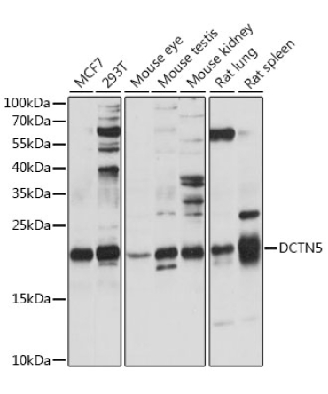 DCTN5 Rabbit Polyclonal Antibody