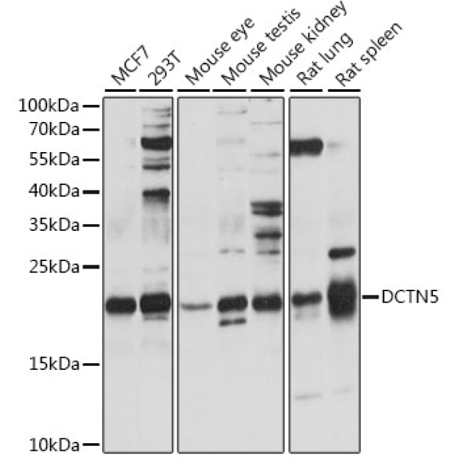 DCTN5 Rabbit Polyclonal Antibody