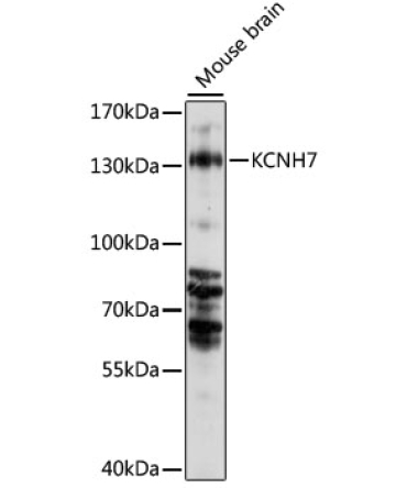 KCNH7 Rabbit Polyclonal Antibody