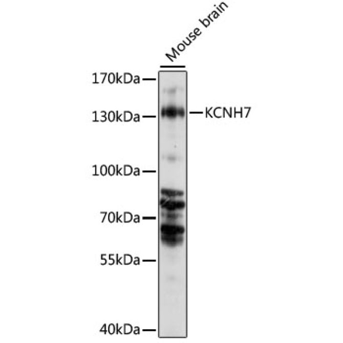 KCNH7 Rabbit Polyclonal Antibody