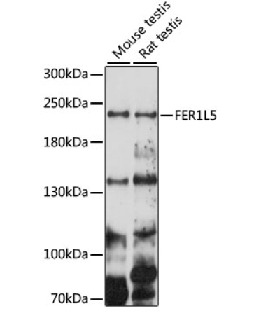FER1L5 Rabbit Polyclonal Antibody