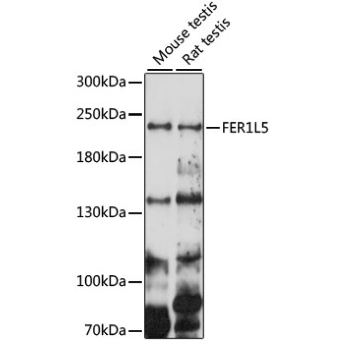 FER1L5 Rabbit Polyclonal Antibody
