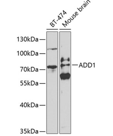 ADD1 Rabbit Polyclonal Antibody