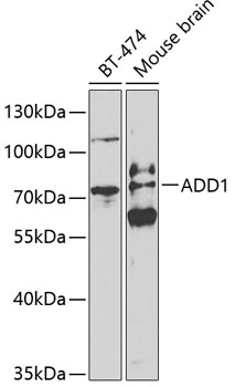 ADD1 Rabbit Polyclonal Antibody
