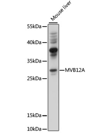 MVB12A Rabbit Polyclonal Antibody