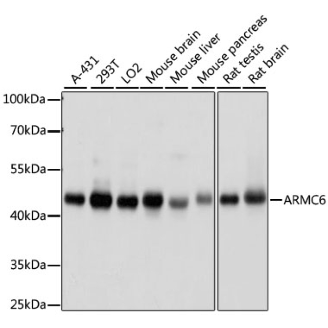 ARMC6 Rabbit Polyclonal Antibody