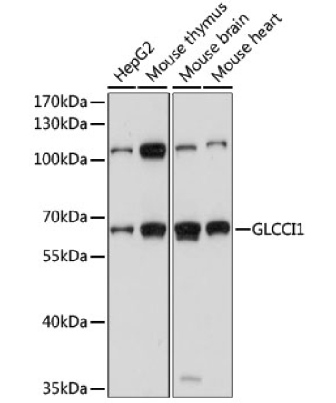 GLCCI1 Rabbit Polyclonal Antibody