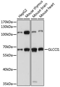 GLCCI1 Rabbit Polyclonal Antibody