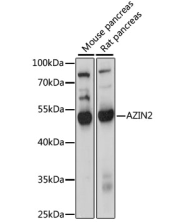 AZIN2 Rabbit Polyclonal Antibody