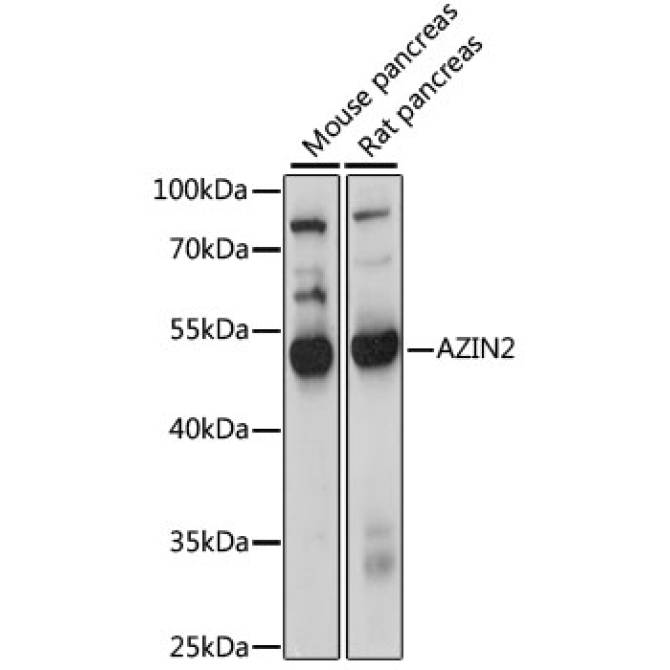 AZIN2 Rabbit Polyclonal Antibody