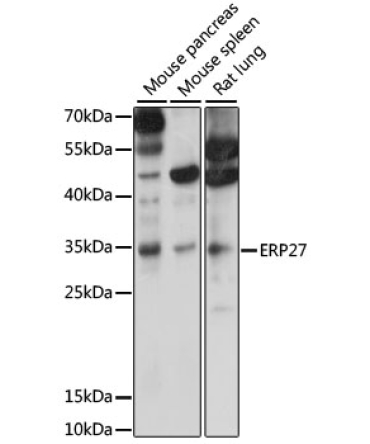 ERP27 Rabbit Polyclonal Antibody