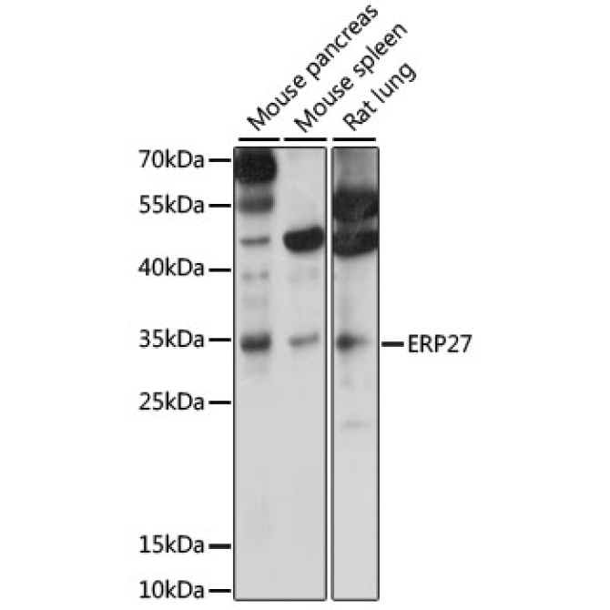 ERP27 Rabbit Polyclonal Antibody