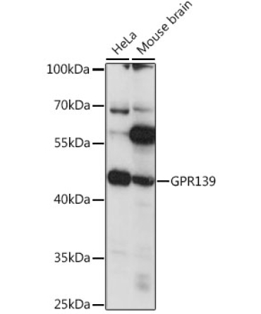 GPR139 Rabbit Polyclonal Antibody