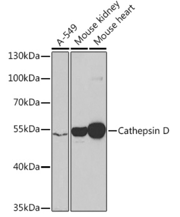 Cathepsin D Rabbit Polyclonal Antibody