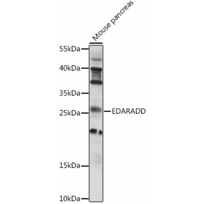 EDARADD Rabbit Polyclonal Antibody