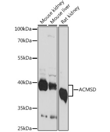 ACMSD Rabbit Polyclonal Antibody
