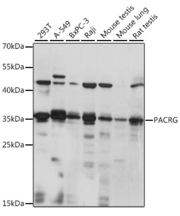 PACRG Rabbit Polyclonal Antibody