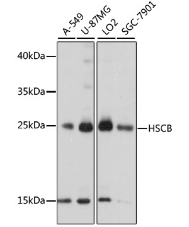 HSCB Rabbit Polyclonal Antibody