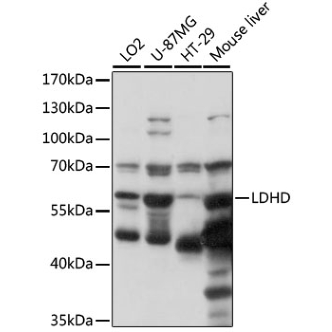 LDHD Rabbit Polyclonal Antibody