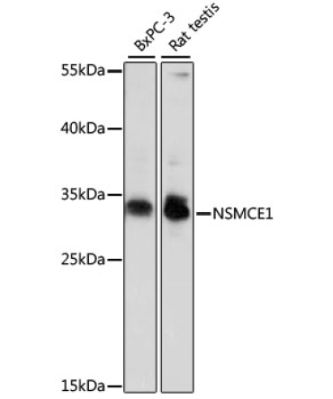 NSMCE1 Rabbit Polyclonal Antibody