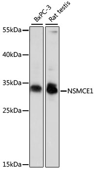 NSMCE1 Rabbit Polyclonal Antibody