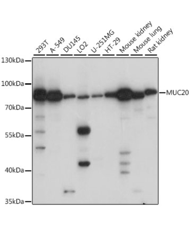 MUC20 Rabbit Polyclonal Antibody