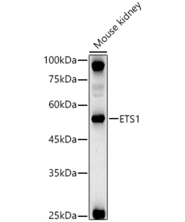 ETS1 Rabbit Polyclonal Antibody