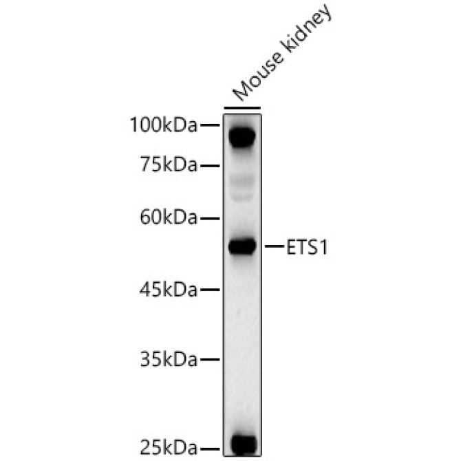ETS1 Rabbit Polyclonal Antibody