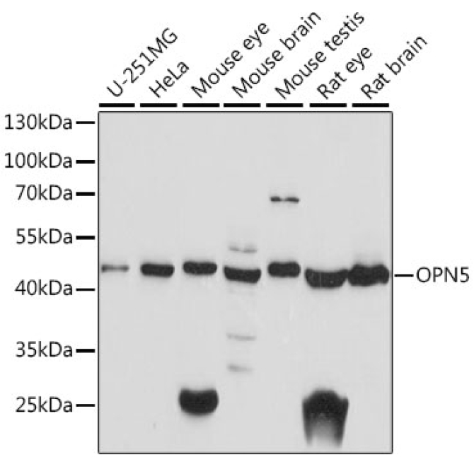 OPN5 Rabbit Polyclonal Antibody