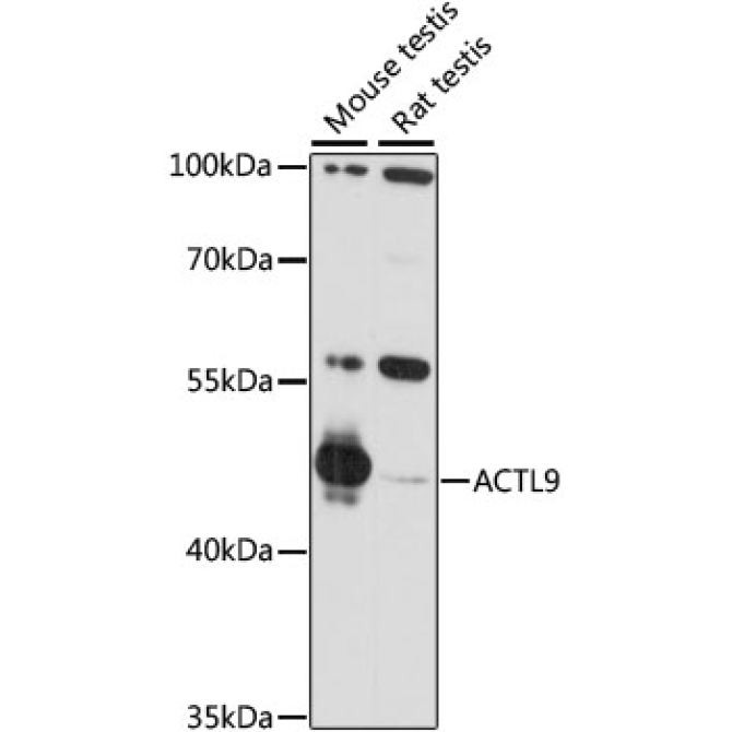 ACTL9 Rabbit Polyclonal Antibody