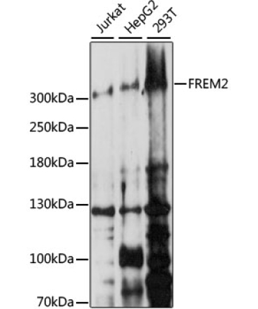 FREM2 Rabbit Polyclonal Antibody