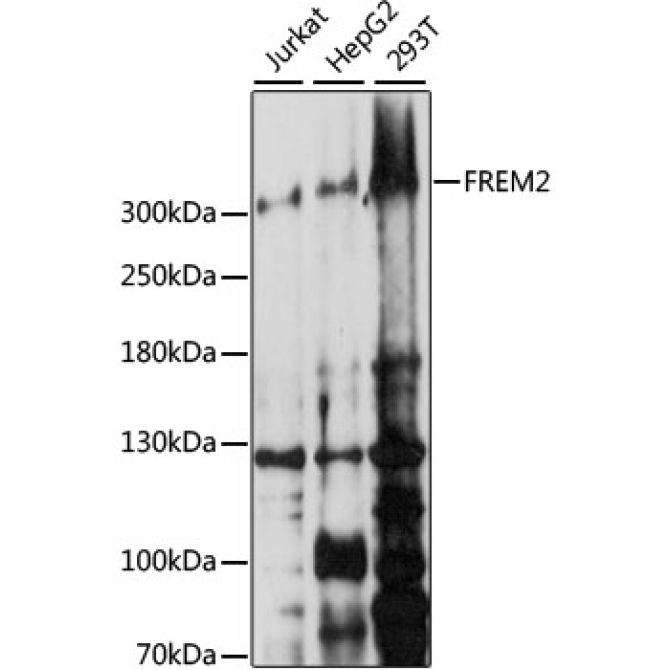 FREM2 Rabbit Polyclonal Antibody