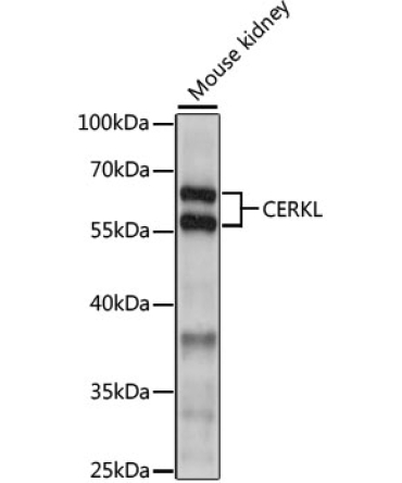CERKL Rabbit Polyclonal Antibody