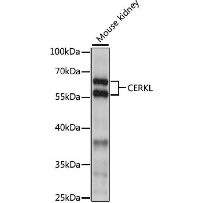CERKL Rabbit Polyclonal Antibody