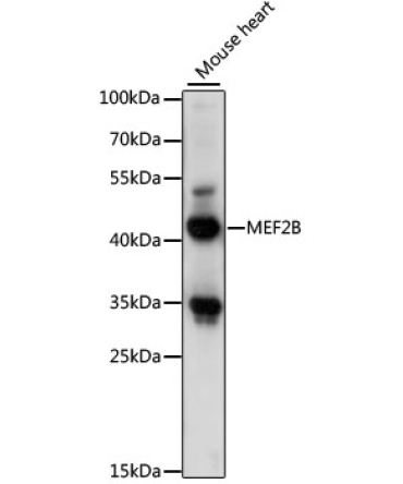MEF2B Rabbit Polyclonal Antibody