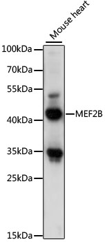 MEF2B Rabbit Polyclonal Antibody