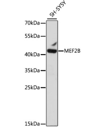 MEF2B Rabbit Polyclonal Antibody