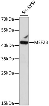 MEF2B Rabbit Polyclonal Antibody