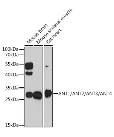 ANT1/ANT2/ANT3/ANT4 Rabbit Polyclonal Antibody