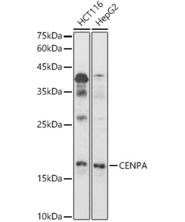 CENPA Rabbit Polyclonal Antibody