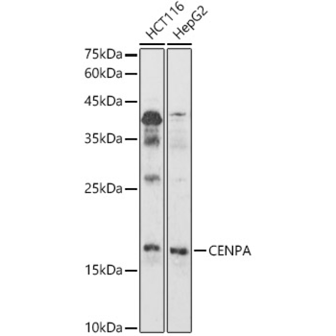 CENPA Rabbit Polyclonal Antibody